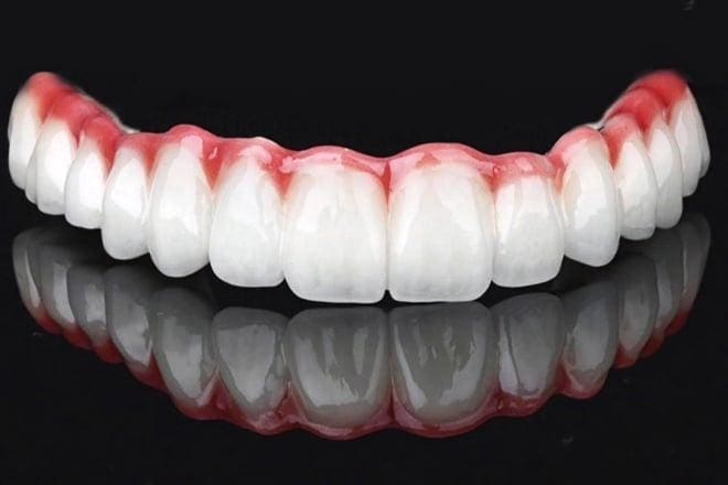 yalova dental park All on Four implant