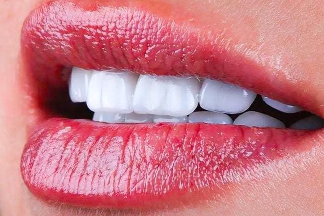 yalova lamine kaplama