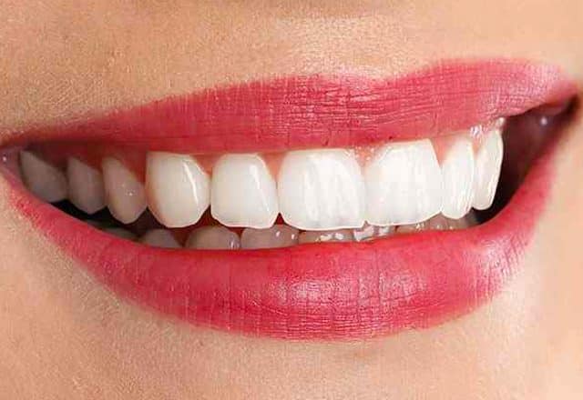 Zirkonyum Diş Tedavisi