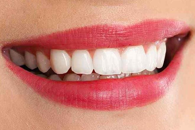 dental park Yalova tam ağız implant