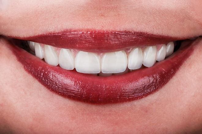 yalova gülüş tasarımı